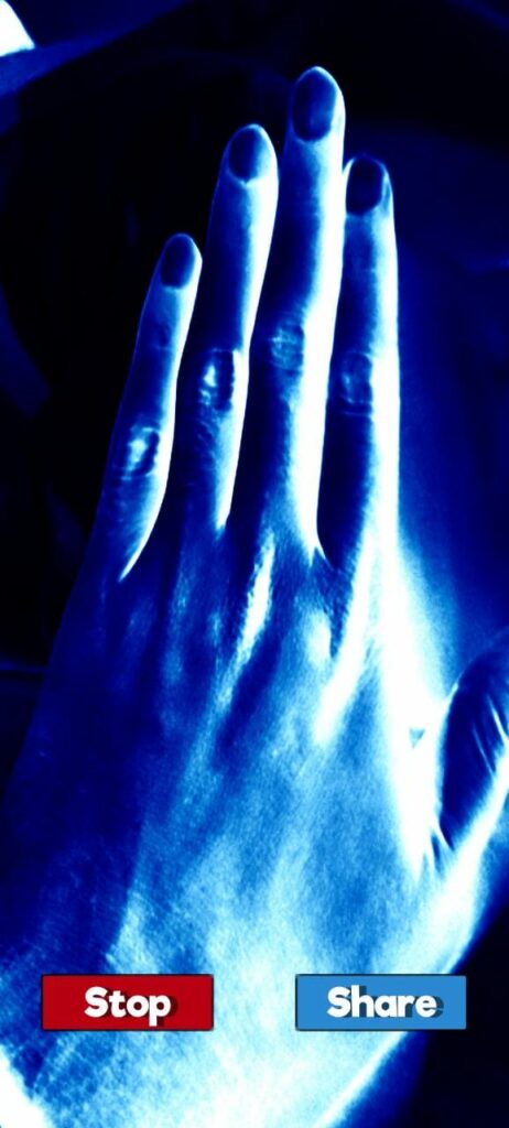 Download X-Ray Scanner APK v1.7.6 for Android 2024 2